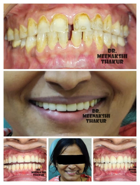 Slider image (3) Dr. Thakurs NexGen